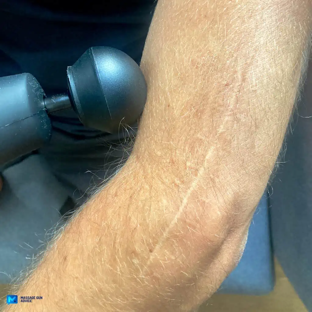 Massage Gun for Scar Tissue - What a PT Wants You to Know 3 best scar tissue massage tool