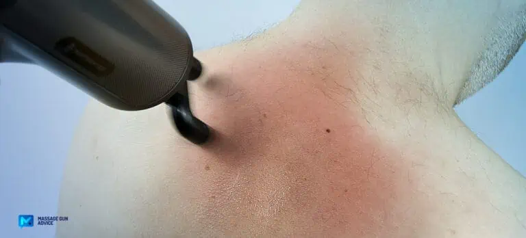 Itchy After Massage Gun? Here’s Why And 4 Things You Can Do 3 Itchy After Massage Gun