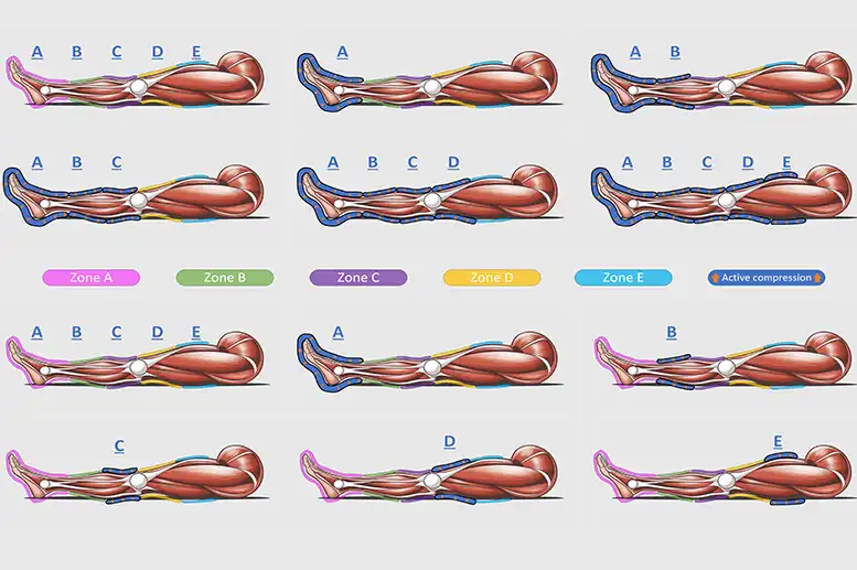Complete Guide to Compression Therapy: What It Is and How It Benefits You 4 Leg Compression therapy - Normatec compression boots explained