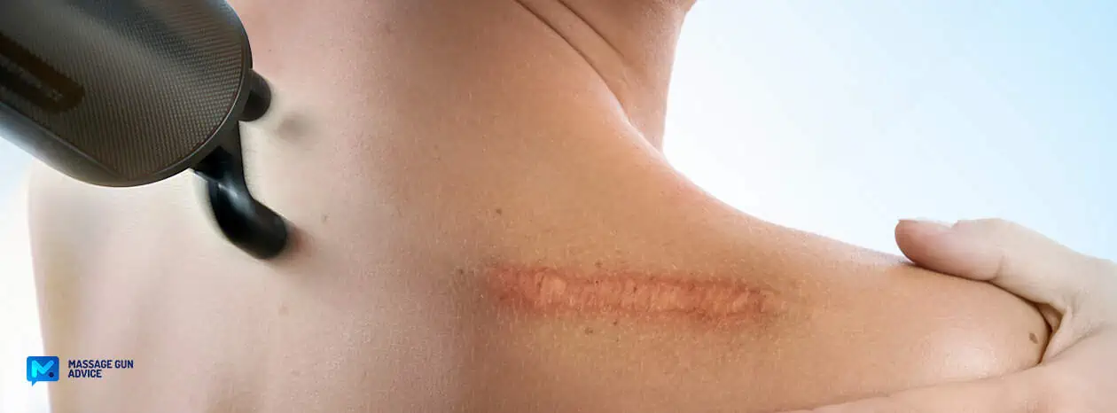 Massage Gun for Scar Tissue - What a PT Wants You to Know 1 vibrating massager for scar tissue