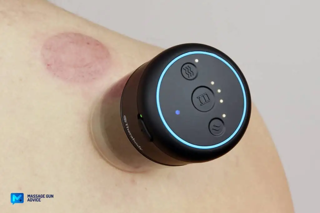 What Toxins Are Released After Massage? Demystifying Detoxification 4 cupping therapy massagers on person's shoulder